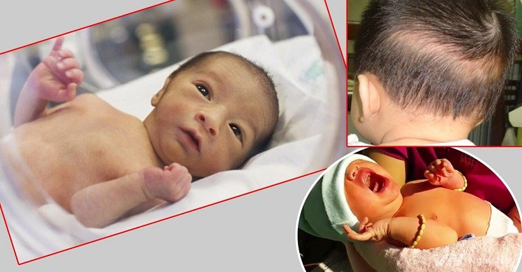 Dấu hiệu nhận biết trẻ còi xương