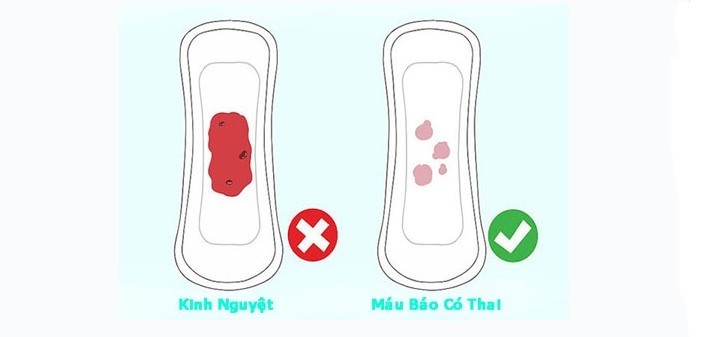 Những dấu hiệu mang thai tuần đầu dấu hiệu mang thai tuần đầu tiên, những dấu hiệu mang thai tuần đầu, các dấu hiệu mang thai tuần đầu, những dấu hiệu mang thai tuần đầu tiên, dấu hiệu mang thai tuần đầu webtretho, các dấu hiệu mang thai tuần đầu tiên, dấu hiệu mang thai tuần đầu tiên webtretho, 10 dấu hiệu mang thai tuần đầu tiên, dấu hiệu mang thai tuần đầu đau bụng, dấu hiệu mang thai tuần đầu sau quan hệ