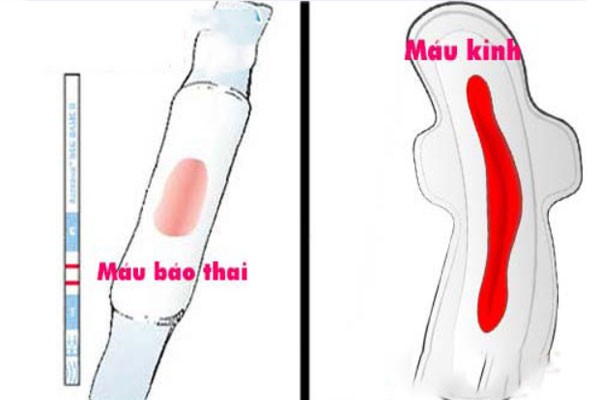 Giải đáp tại sao mang thai mà vẫn có kinh đều Giải đáp tại sao mang thai mà vẫn có kinh đều