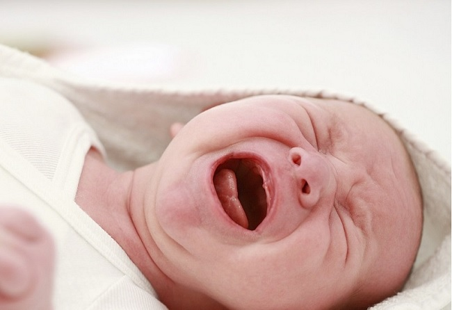 Nanh sữa là những chấm nhỏ trên nền lợi màu hồng nhạt của trẻ sơ sinh