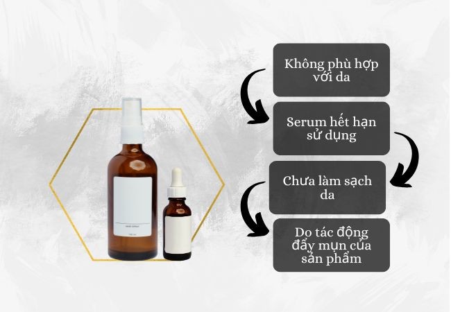 Nguyên nhân sử dụng serum B5 bị nổi mụn
